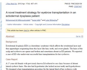 A novel treatment strategy for eyebrow transplantation in an ectodermal dysplasia patient