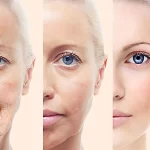 جوانسازی پوست و صورت