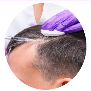 تزریق-هیر-فیلر