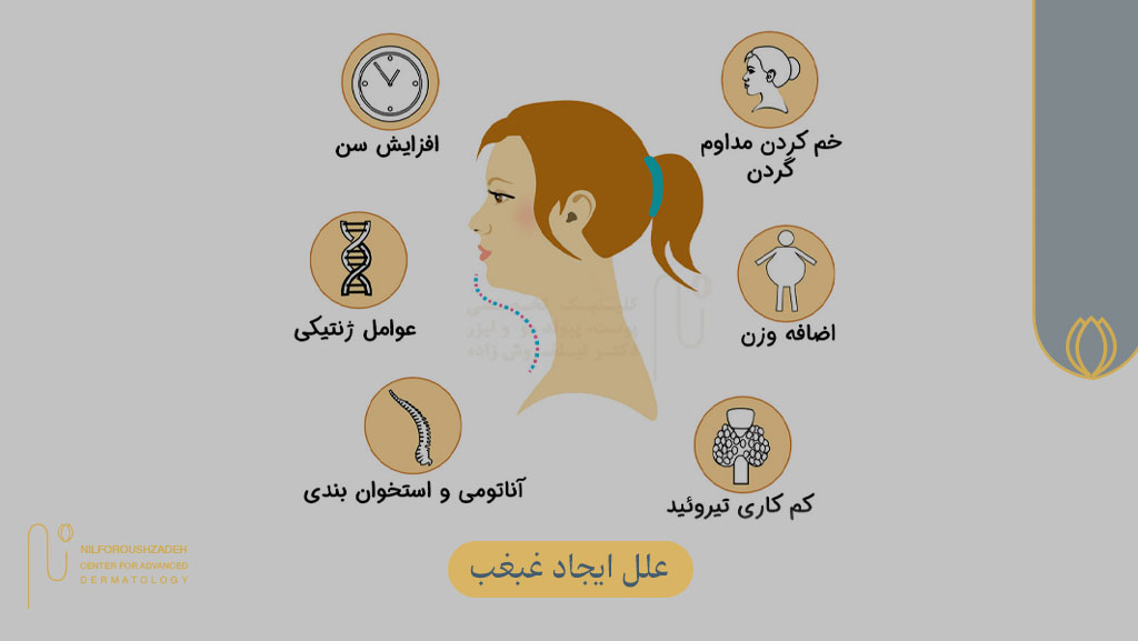 علل ایجاد غبغب