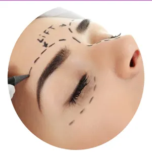 لیفت-چشم-با-بوتاکس