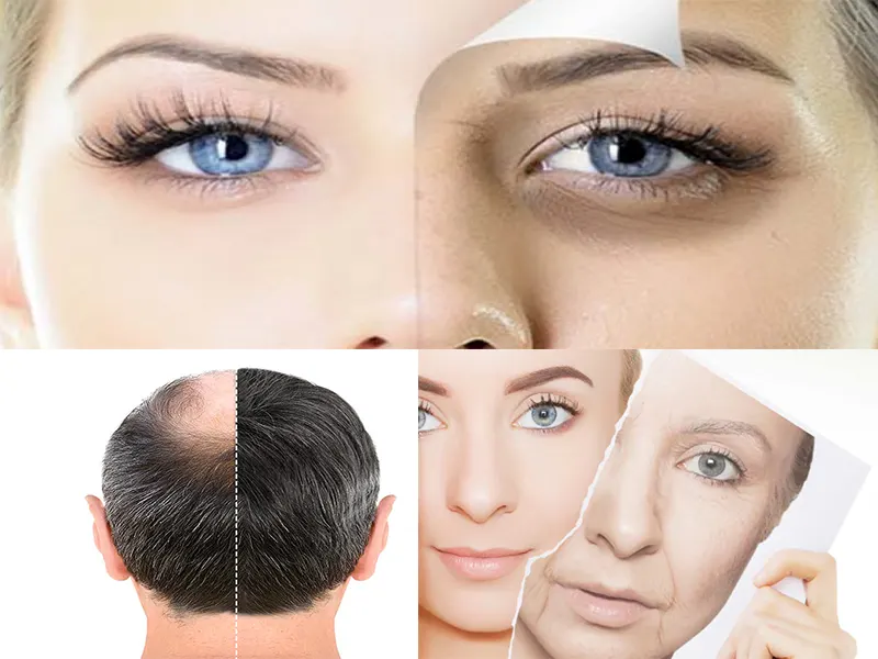 متد نوین سلول درمانی در جوانسازی پوست صورت، درمان تیرگی دور چشم و درمان ریزش مو