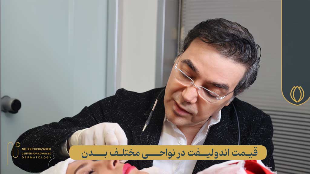 قیمت اندولیفت در نواحی مختلف بدن