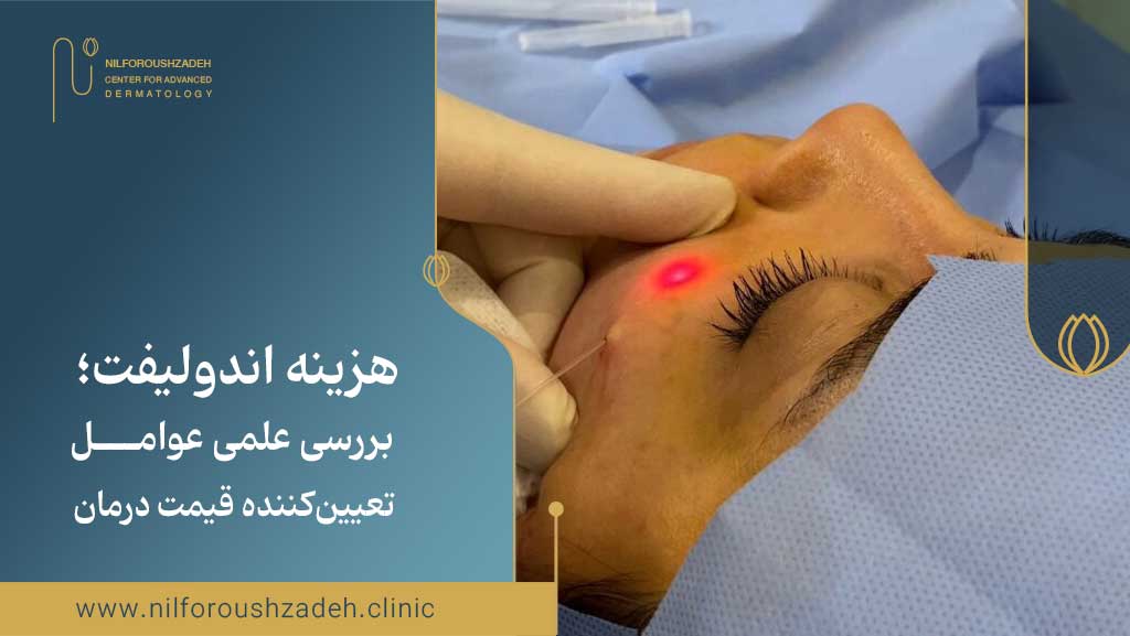 هزینه اندولیفت؛ بررسی علمی عوامل تعیینکننده قیمت درمان