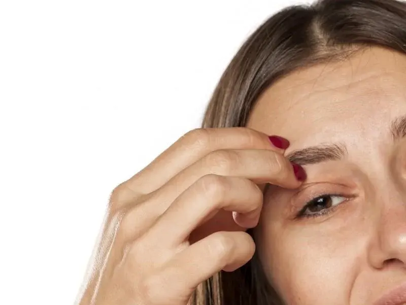 خارش ابرو بعد از کاشت