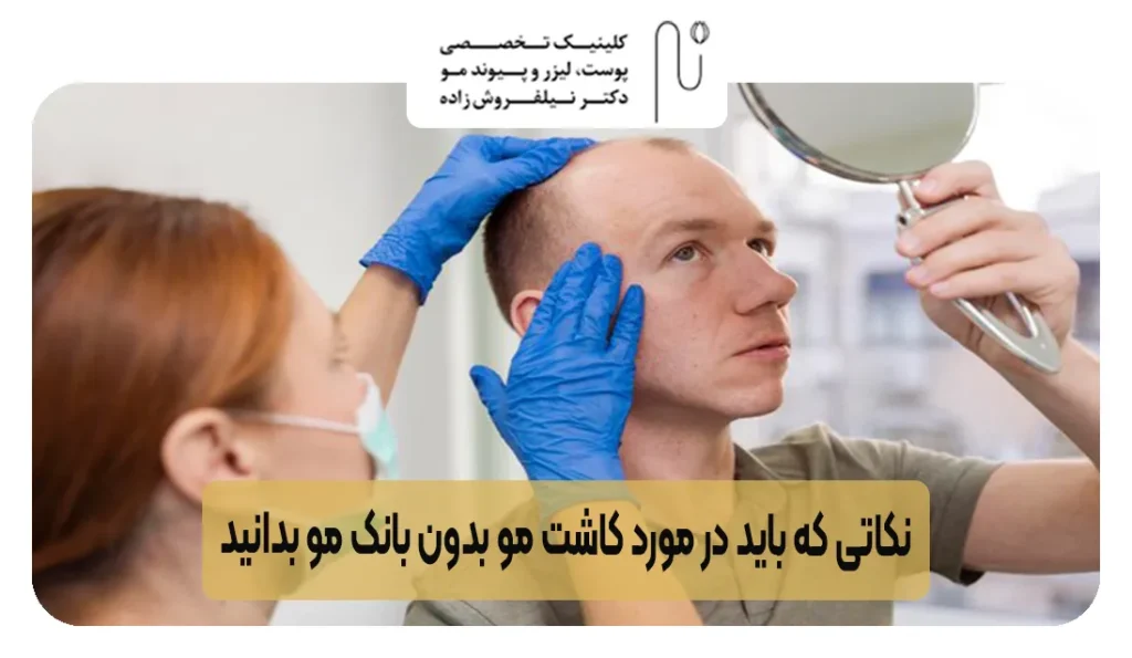 نکاتی که باید در مورد کاشت مو بدون بانک مو بدانید  | کلینیک نیل فروش زاده