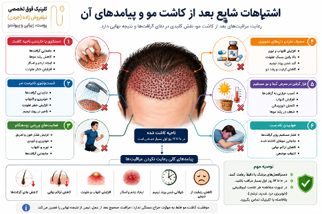 اشتباهات رایج بعد از کاشت مو