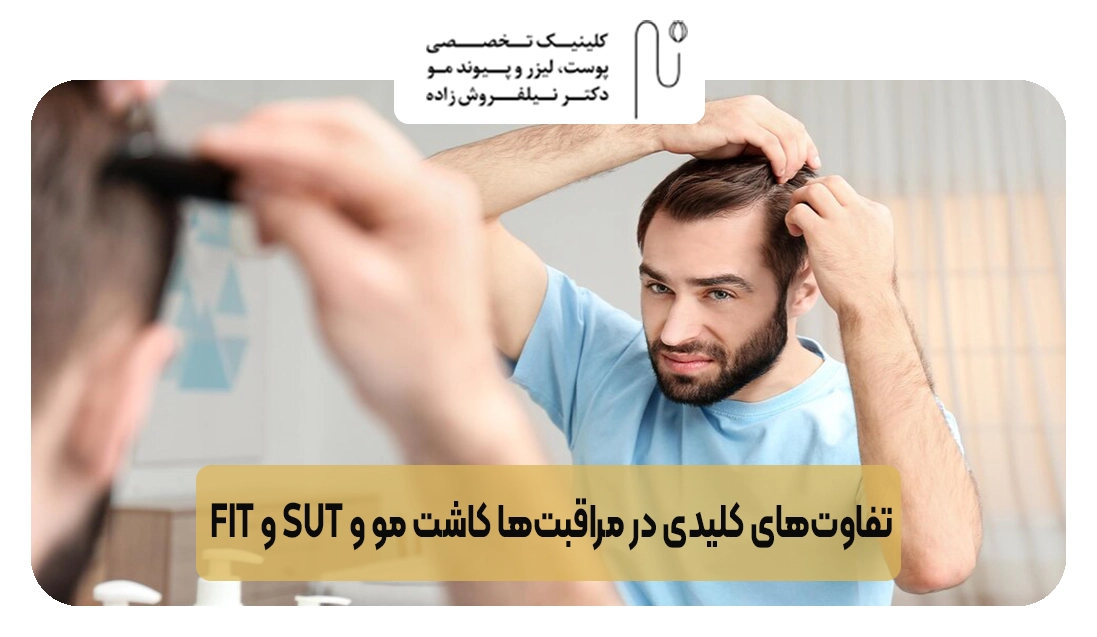 تفاوت‌های کلیدی در مراقبت‌ها کاشت مو fit و sut | کلینیک نیلفروش زاده