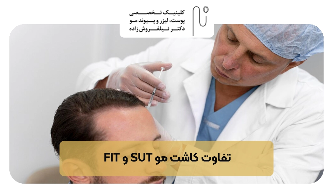 تفاوت کاشت مو FIT و SUT | کلینیک نیلفروش زاده