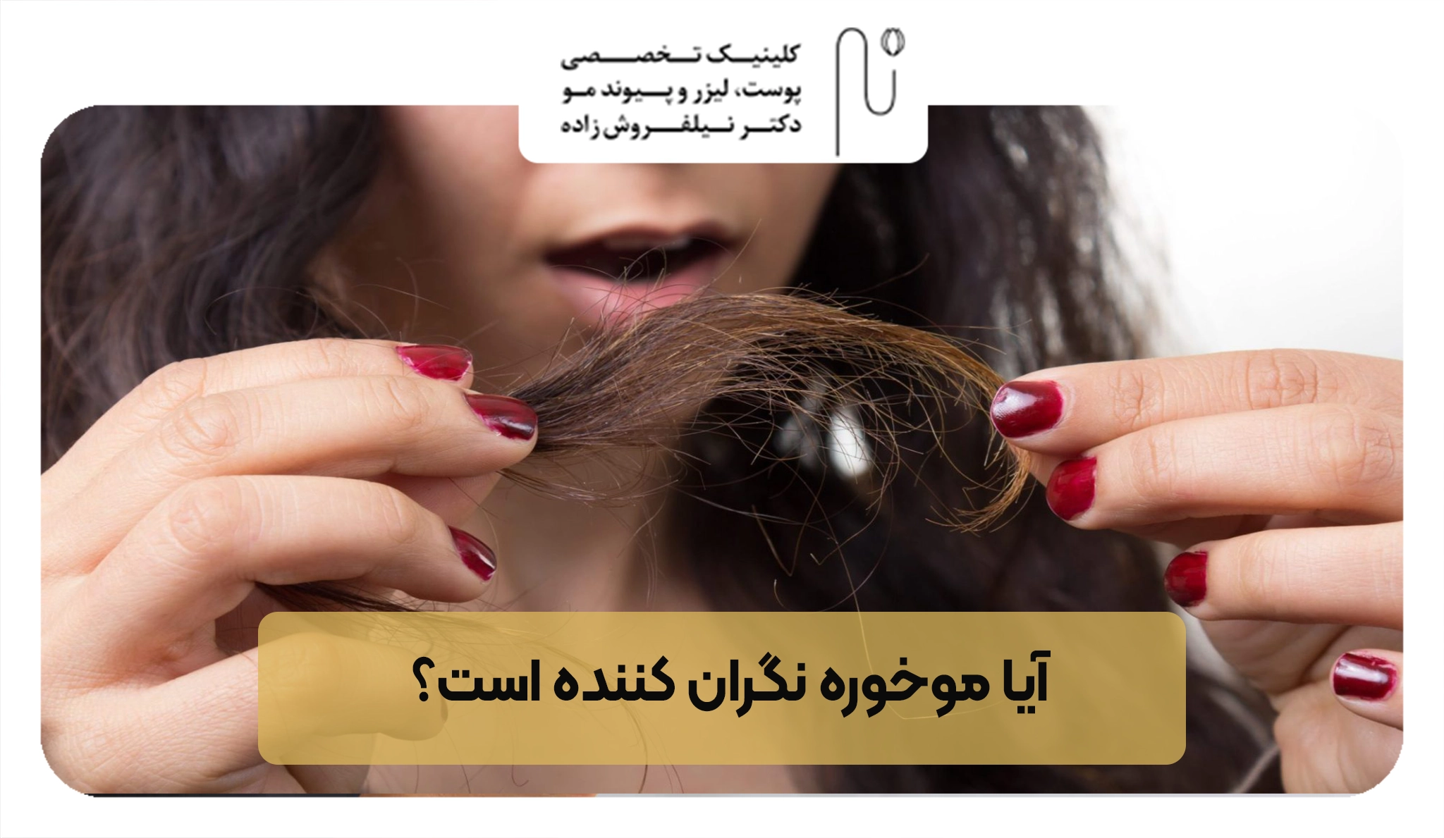 آیا موخوره نگران کننده است؟ | کلینیک نیلفروش زاده