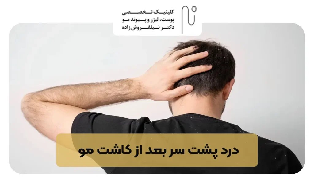 درد پشت سر بعد از کاشت مو | کلینیک نیلفروش زاده