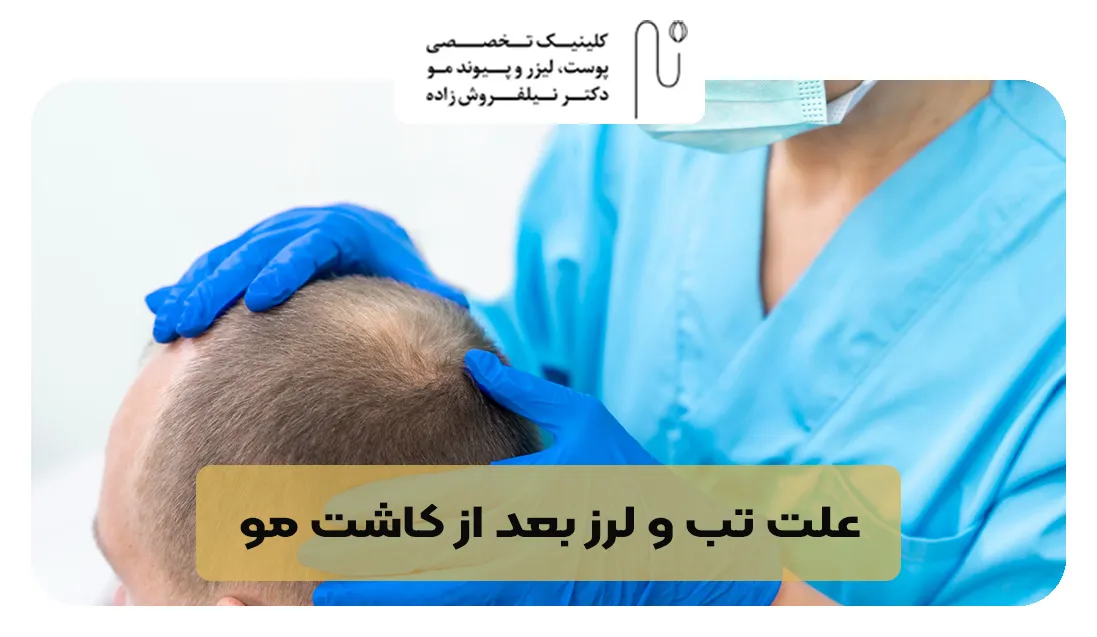 علت تب و لرز بعد از کاشت مو | کلینیک نیلفروش زاده