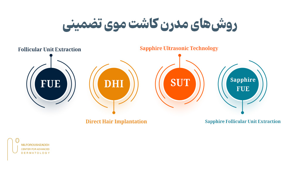 روشهای مدرن کاشت موی تضمینی