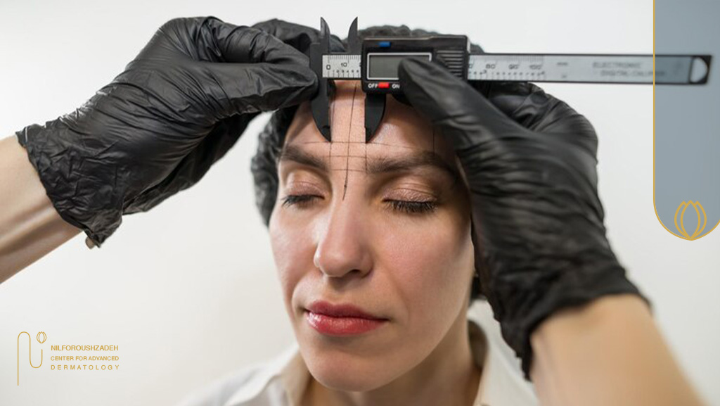 ظرافت کاشت ابرو در تهران