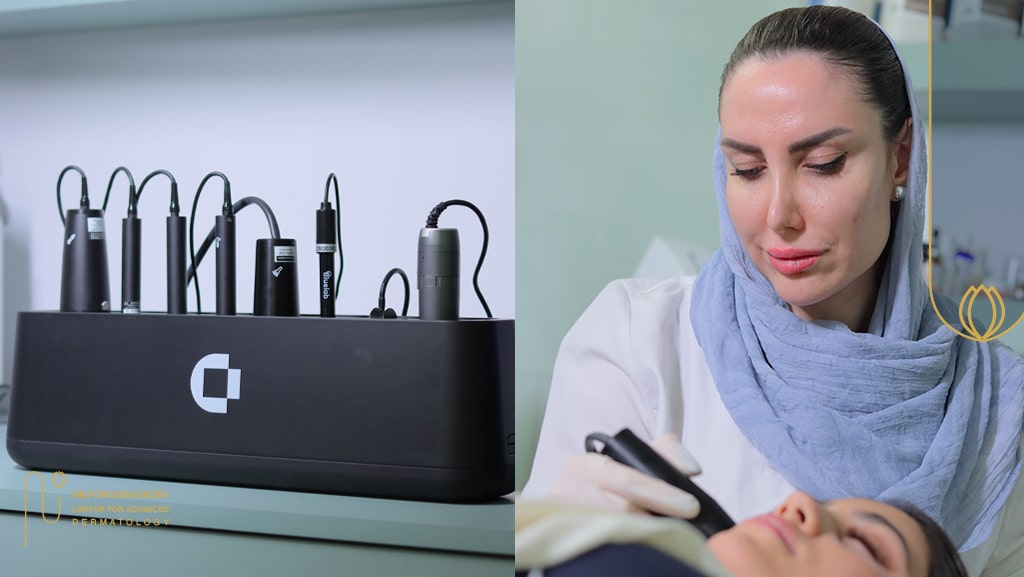 لیفت صورت در کلینیک جردن