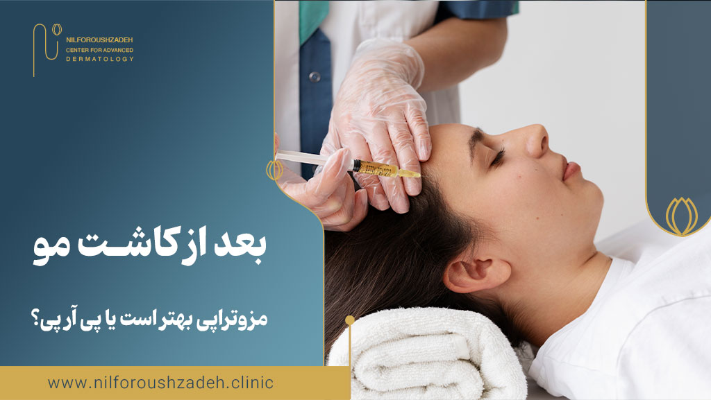 مزوتراپی بهتر است یا پی آر پی