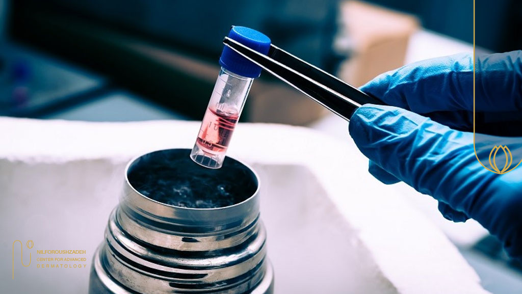 کاشت مو با سلولهای بنیادی