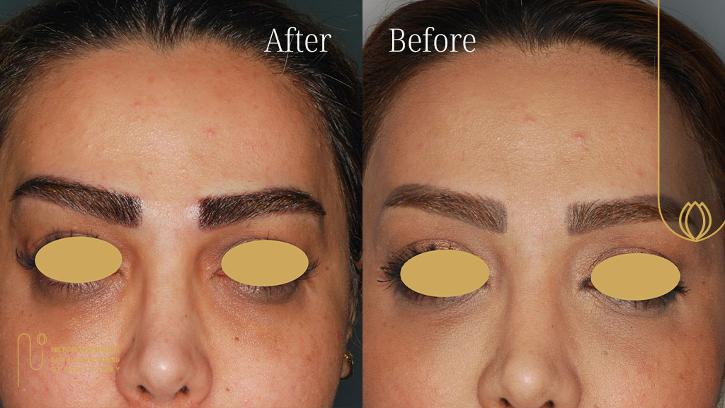 چرا اولین فرم دهی نهایی را باید به کلینیک پروفسور نیلفروش زاده سپرد؟