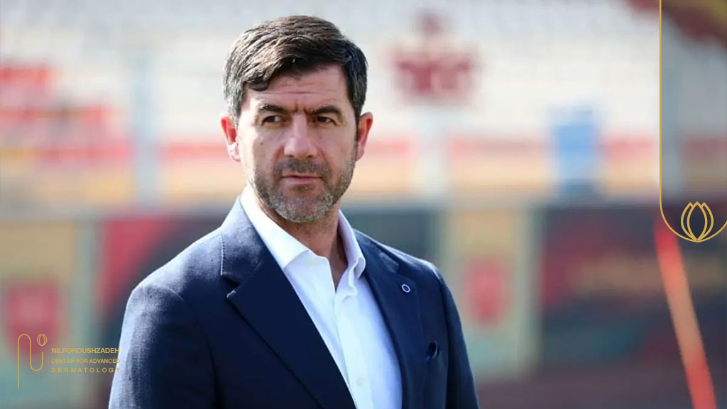 چرا بازیکنهای مشهور به کاشت مو روی میآورند؟