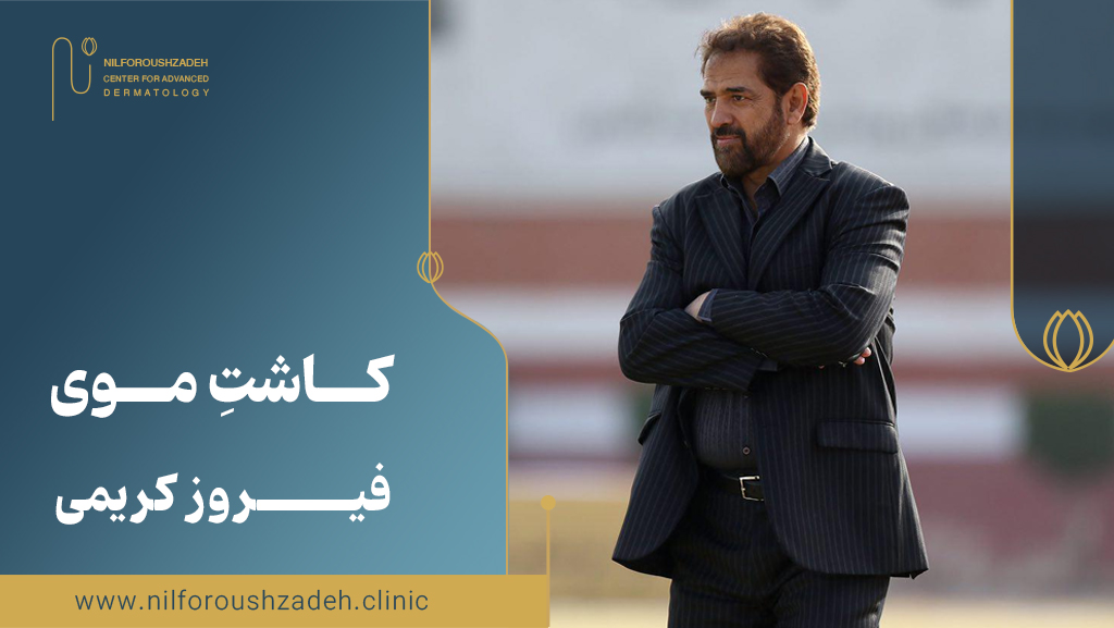 کاشت مو فیروز کریمی