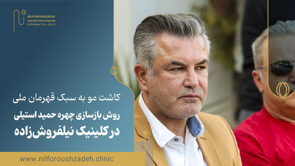 کاشت مو حمید استیلی