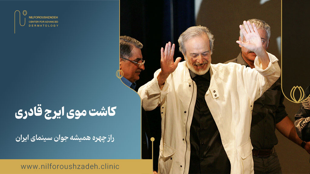 کاشت موی ایرج قادری