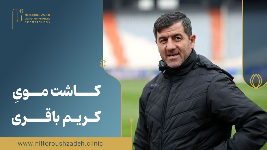 کاشت موی کریم باقری