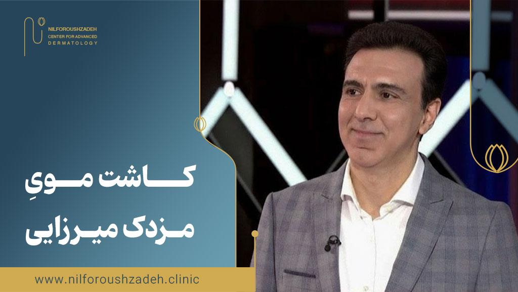کاشت موی مزدک میرزایی