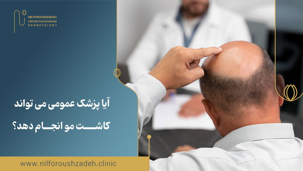 آیا پزشک عمومی می تواند کاشت مو انجام دهد؟
