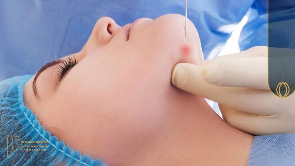 خدمات بهترین دکتر اندولیفت