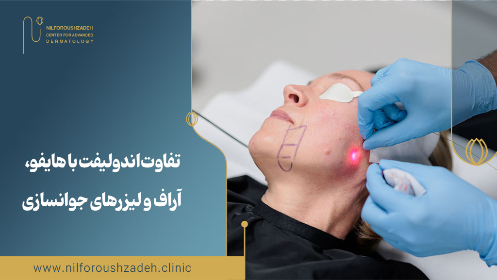 تفاوت اندولیفت با هایفو، آر‌اف و لیزرهای جوانسازی