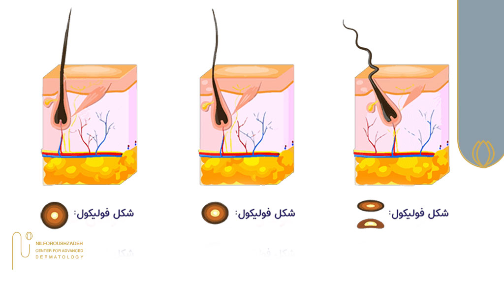 ساختار فولیکول مو
