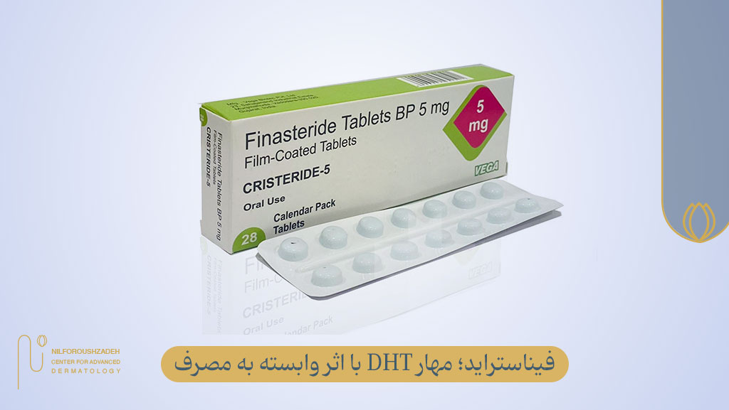 فیناستراید و دوتاستراید، درمان دارویی برای کاهش ریزش مو