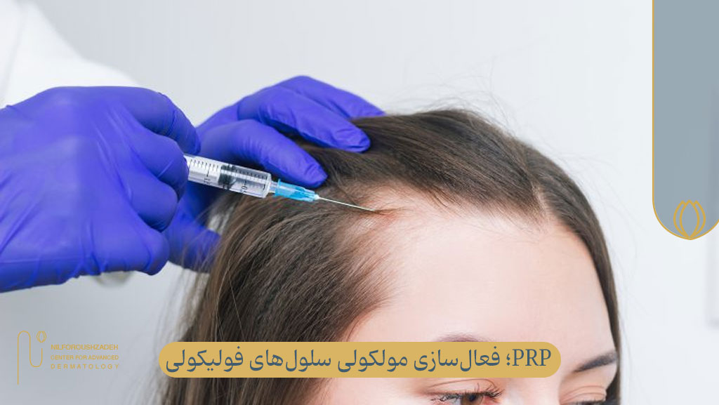 PRP یک متد نوین در درمان ریزش مو