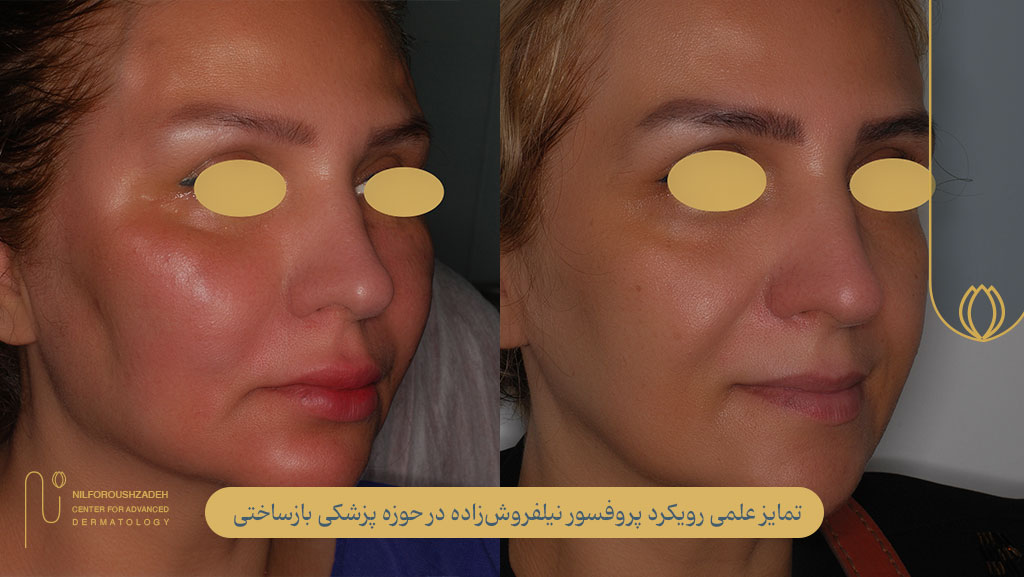 تمایز علمی رویکرد پروفسور نیلفروشزاده در پزشکی بازساختی