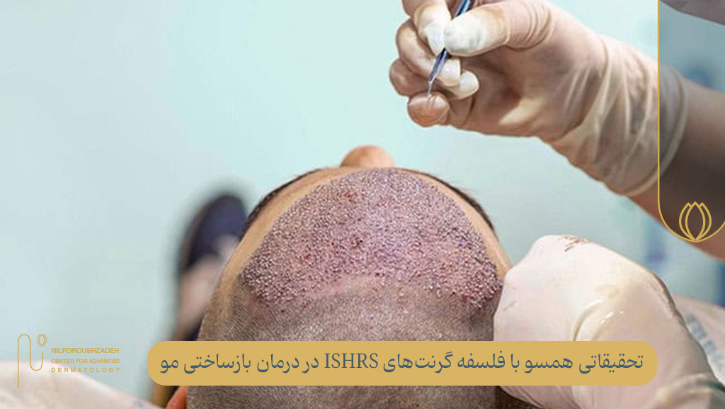 تحقیقاتی همسو با فلسفه گرنت های ISHRS