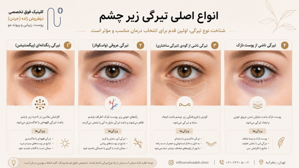 انواع تیرگی زیر چشم
