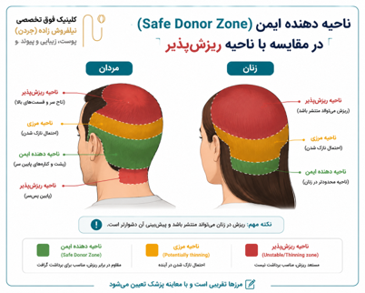 بانک مو چیست و چرا اهمیت دارد؟