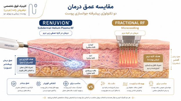 تفاوت اصلی رنوویون و RF فرکشنال در عمق اثر