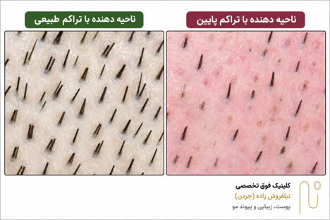 عوامل مهم در ارزیابی بانک مو
