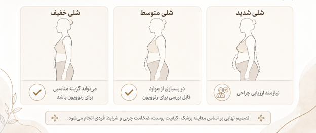 چرا انتخاب بیمار در رنوویون مهم است؟