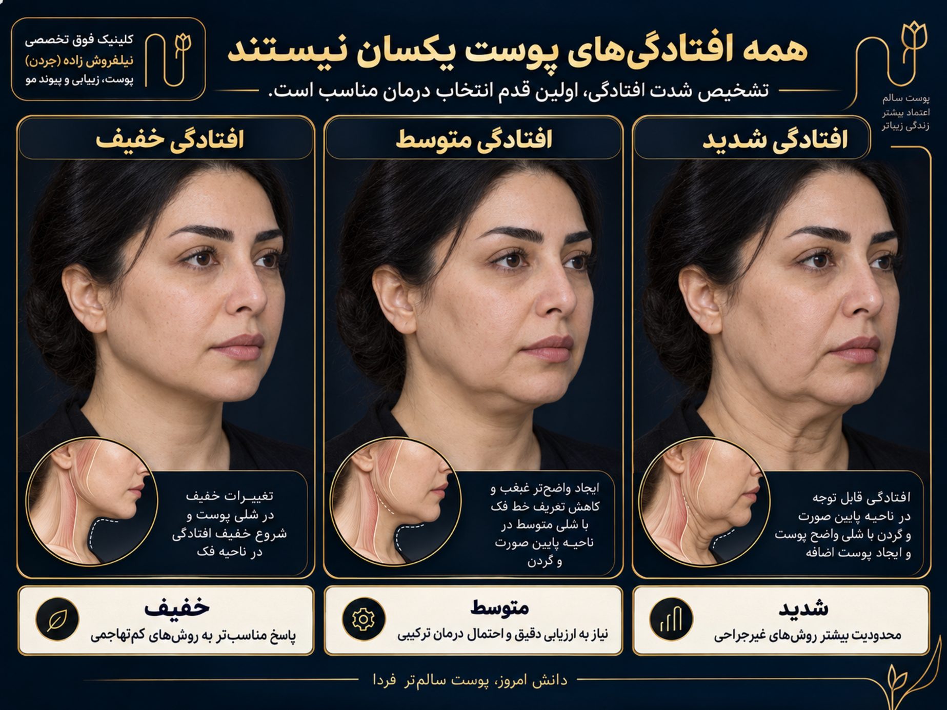 andolift for sagging skin image 03