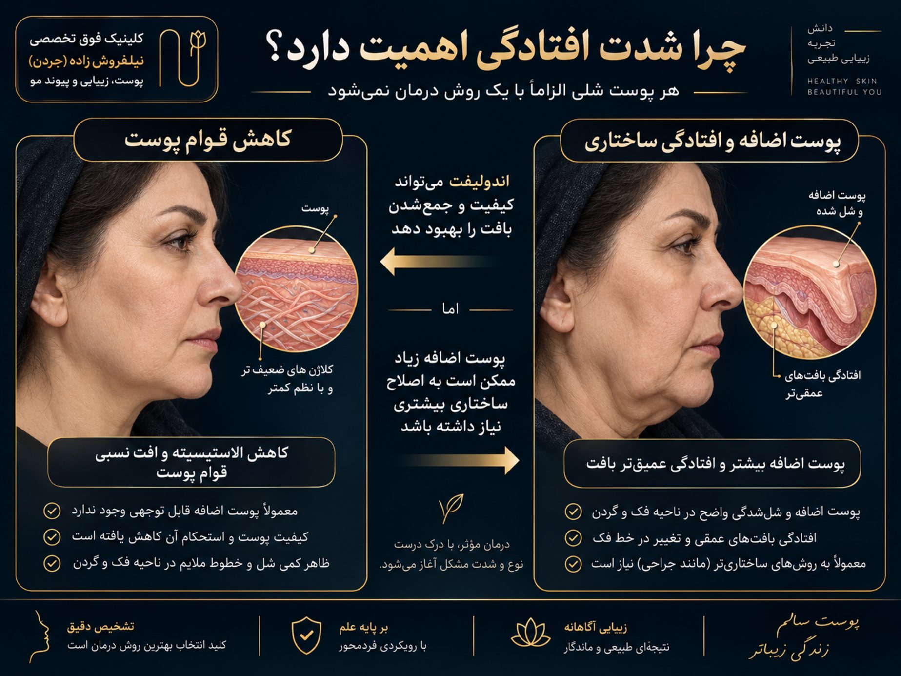 andolift for sagging skin image 06