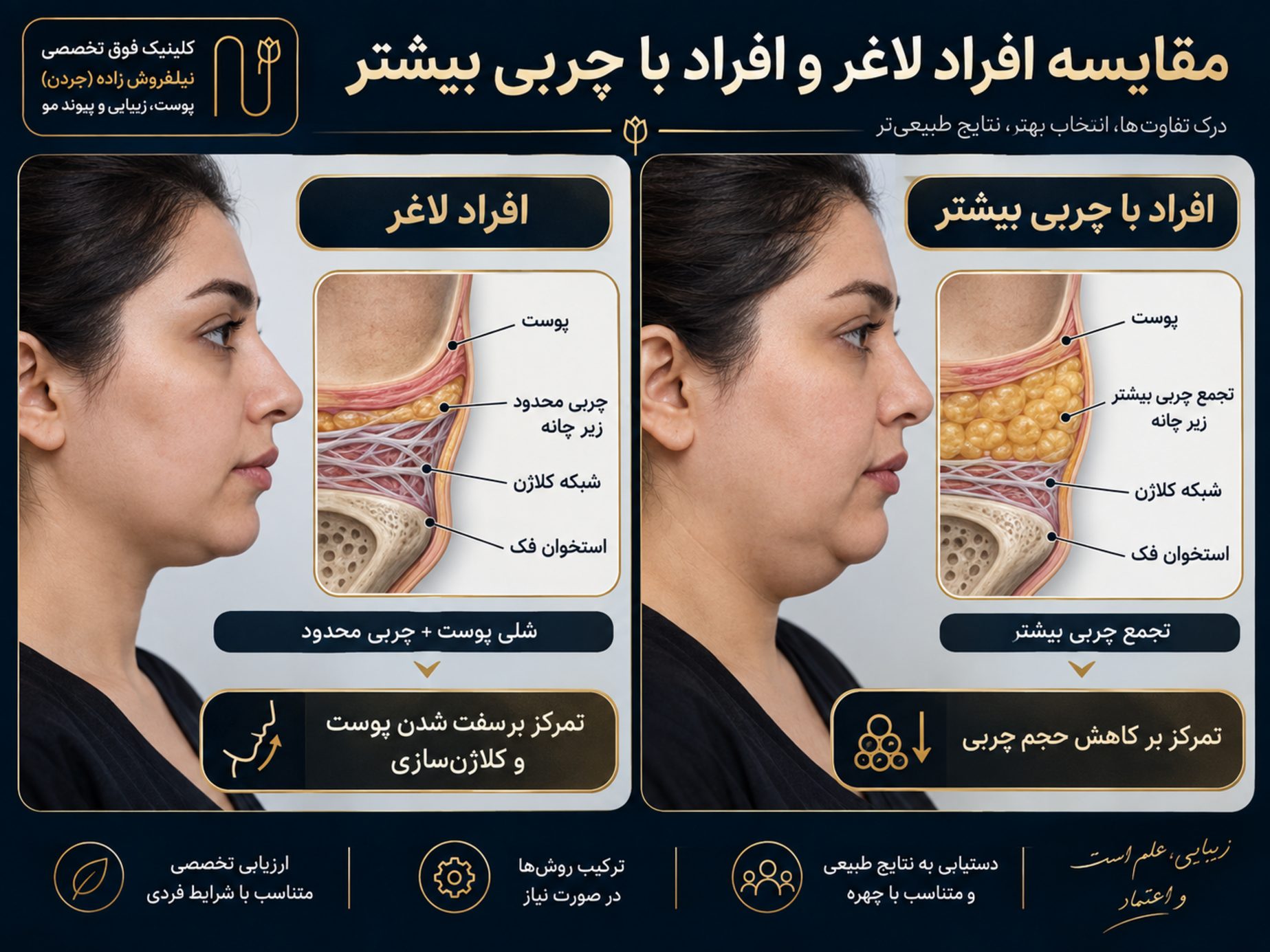 andolift ghabghab baray afrad laghar image 03