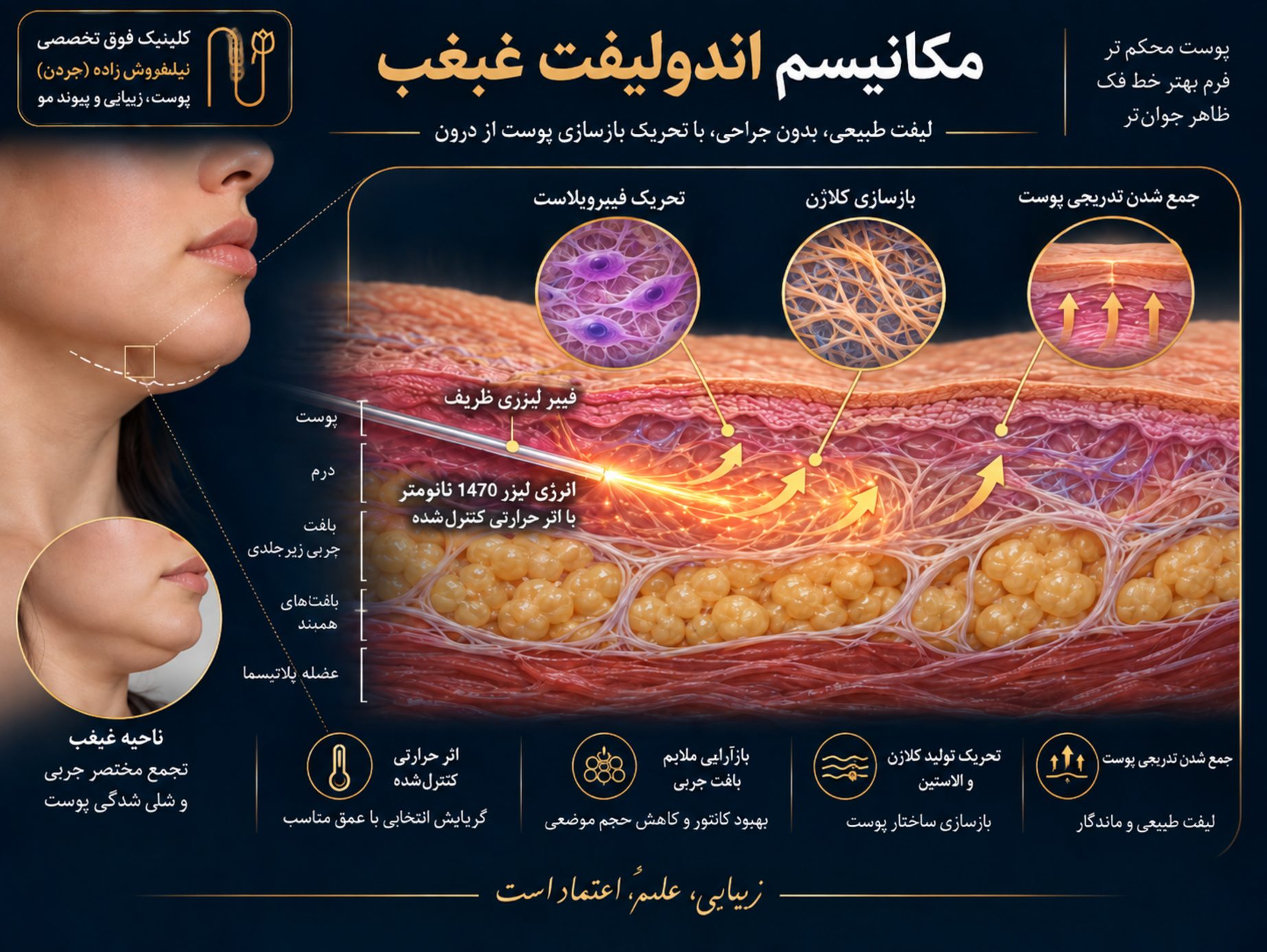 andolift ghabghab baray afrad laghar image 04