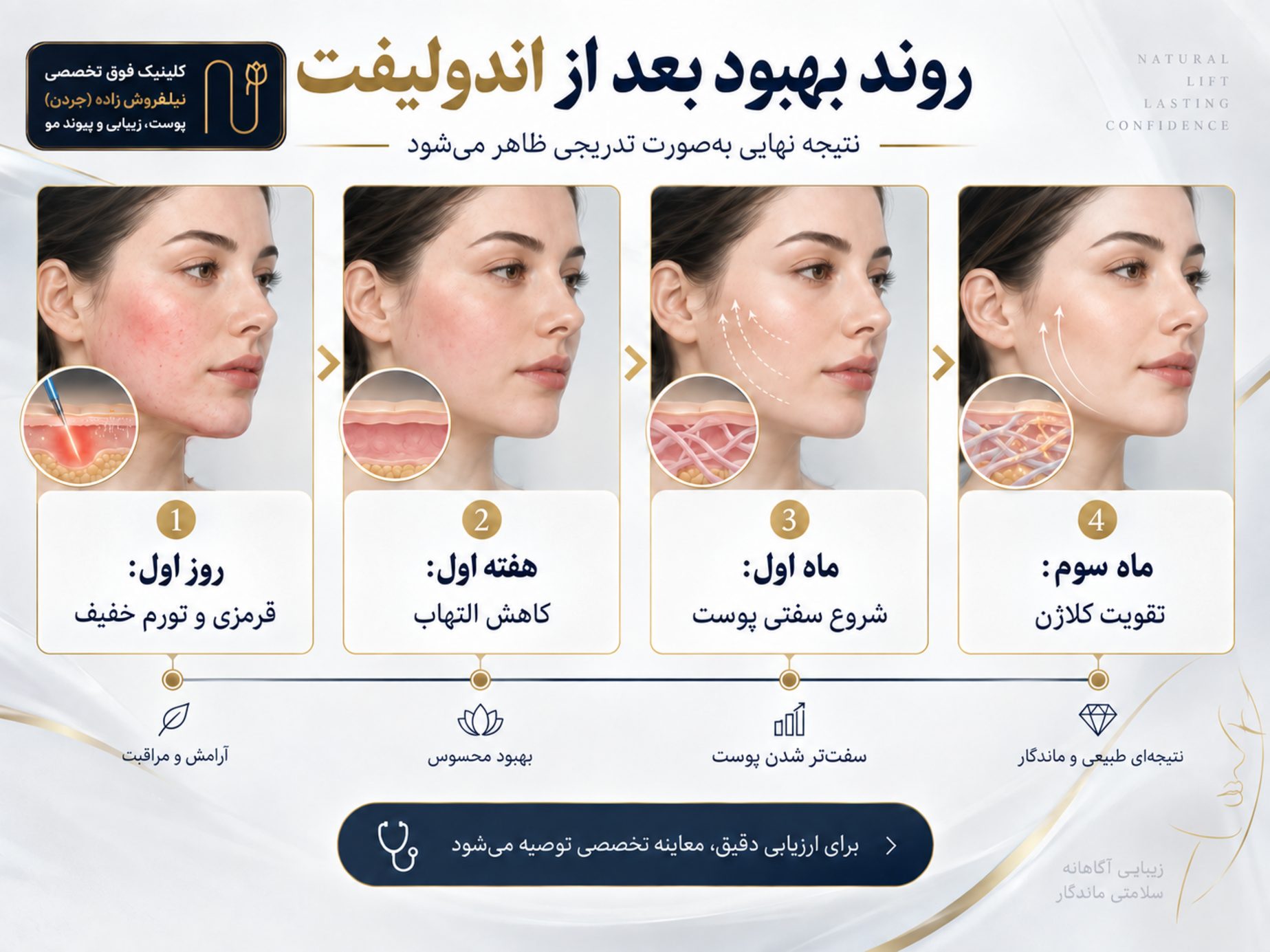 endolift care image 03