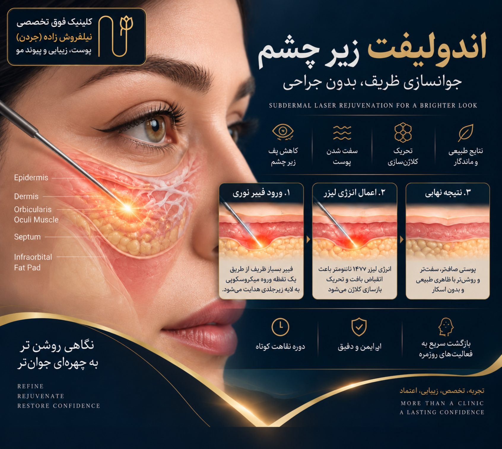 endolift care image 04