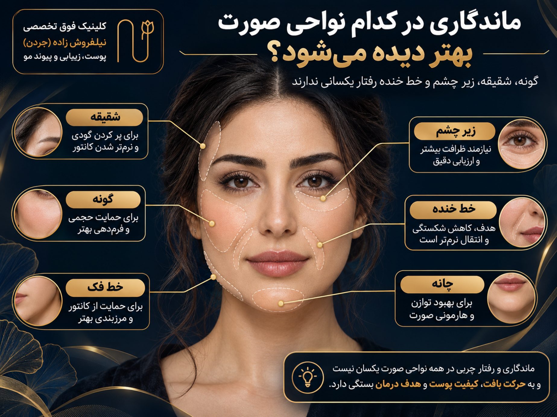 mandegari tazrigh chari be soorat image 02