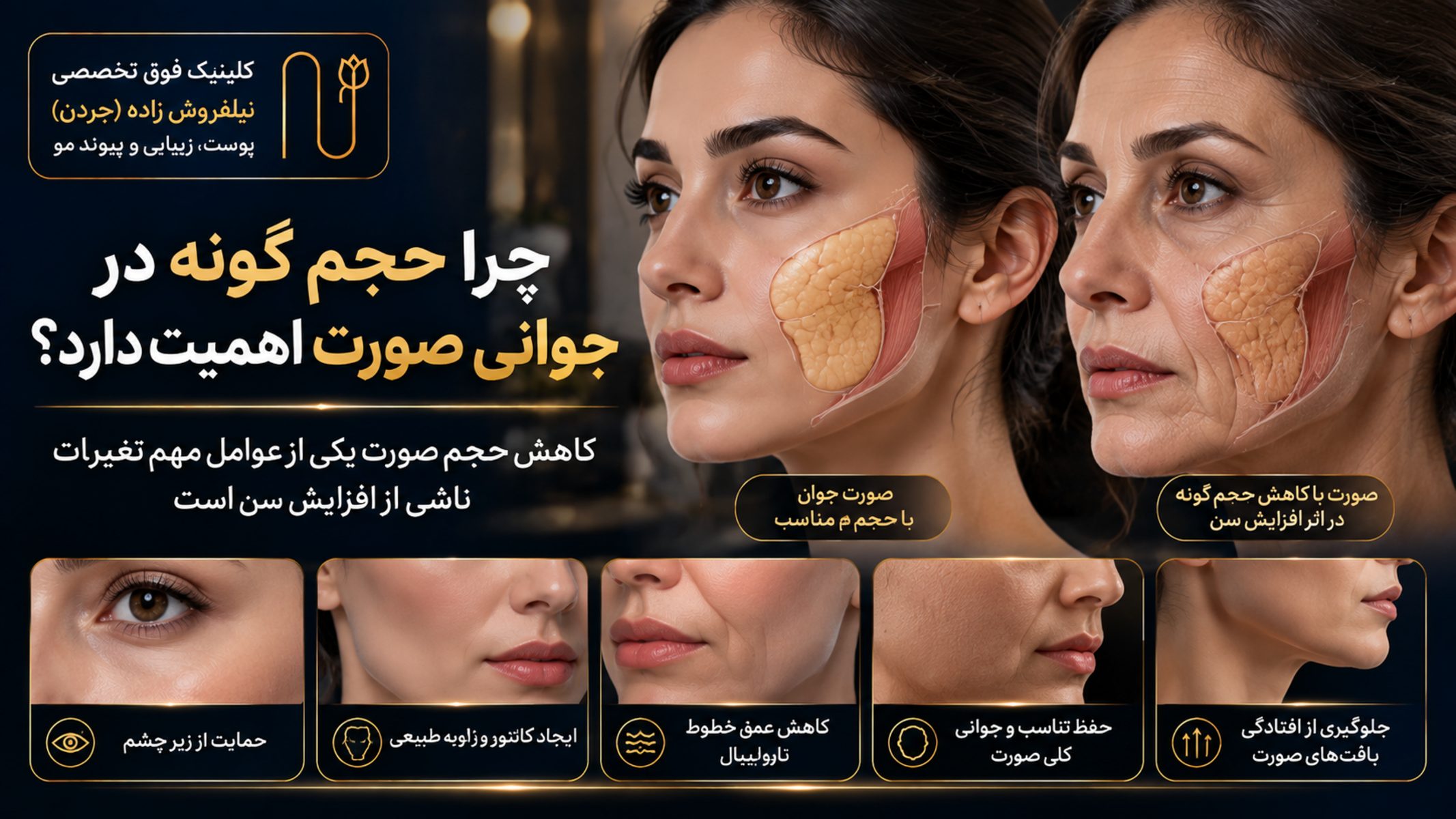natural cheek fat injection vs fillers image 02