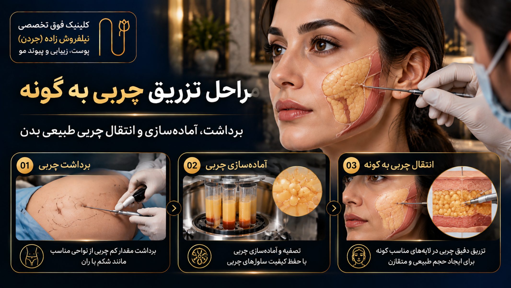 natural cheek fat injection vs fillers image 03